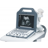 Real Time Ultrasound